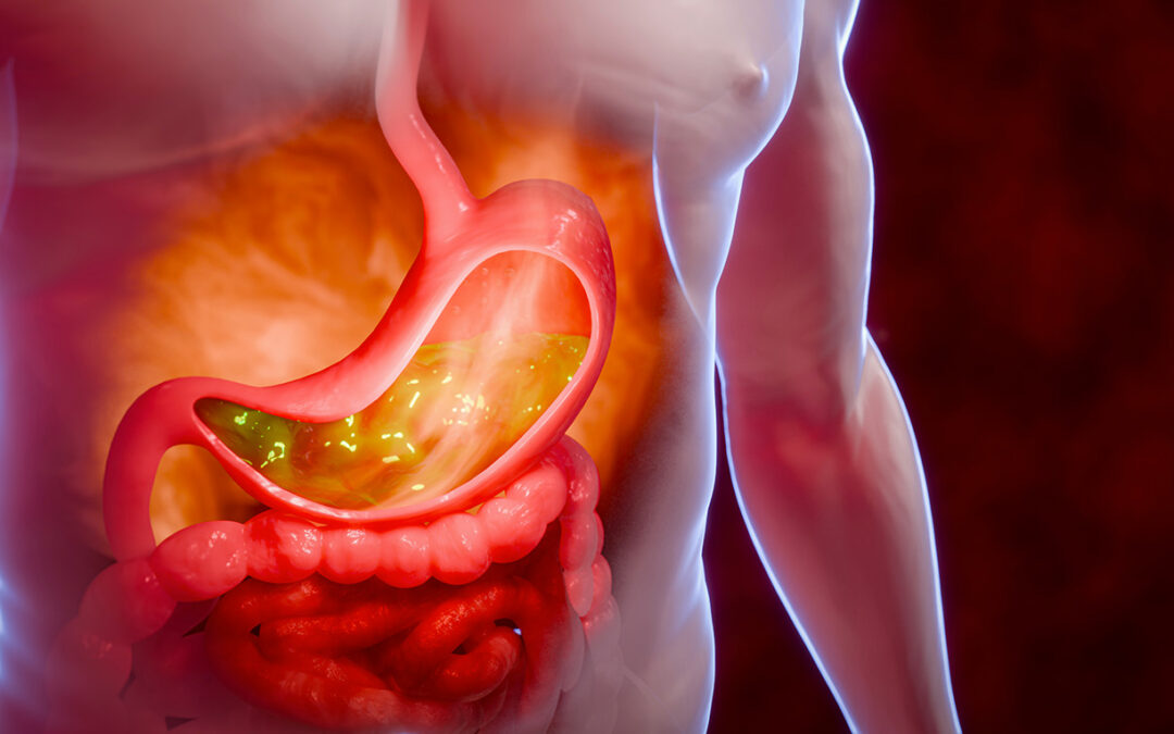 Essais cliniques des cancers digestifs à la Réunion