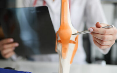 Un robot pour la prothèse du genou à Montpellier