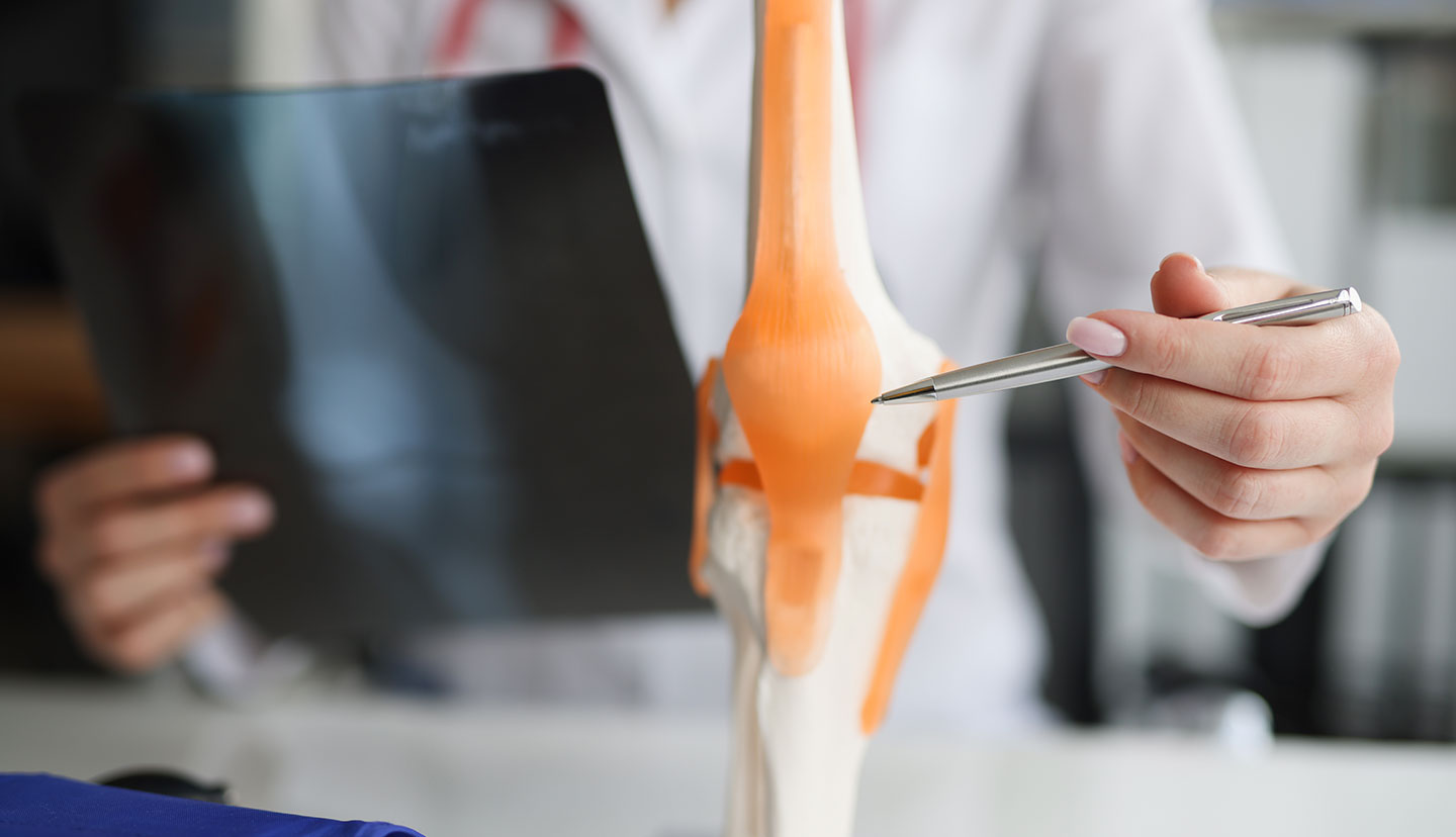 Medical professional points to a knee joint model with orange ligaments, while holding a tablet in the other hand.